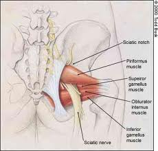 Steroids for sciatic nerve pain